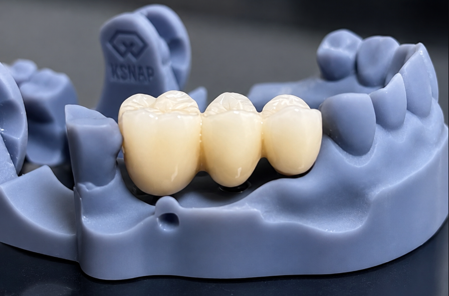 Dental Crowns